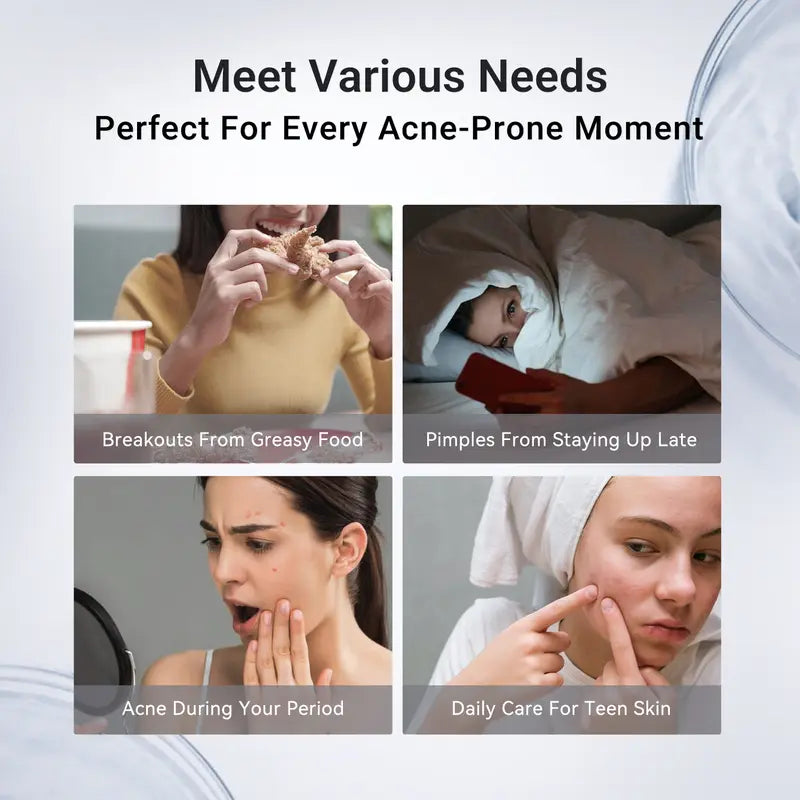 ⚡Crazy-Sale⚡60k-Sold⚡Drying Lotion Plus | Acne & Pimple Treatment | Visibly Shrinks Pimples in 24 Hours & Helps Fade Acne Marks in 7 Days-A01
