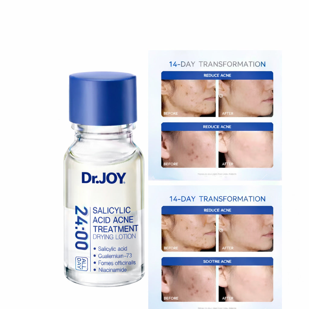 🏆Flash Sale⚡ 50K+ SOLD! 🏆Pimple Treatment & Body Acne Treatment-ZDQ8