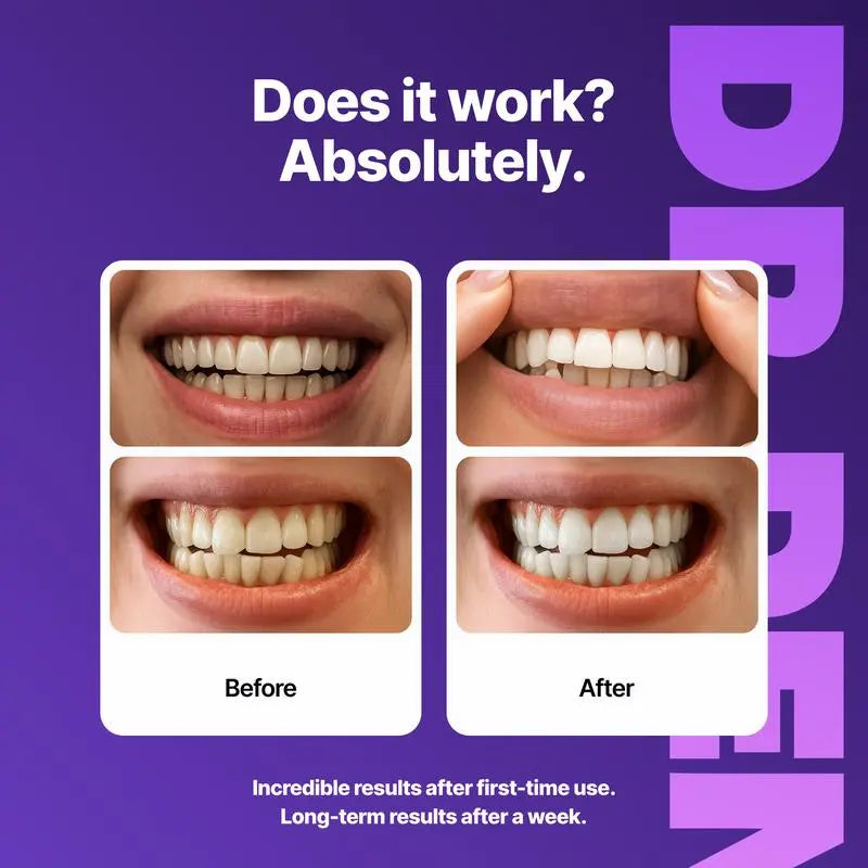 ⚡Flash-Sale⚡100k-sold⚡DRDENT Purple Teeth Whitening Strips - Safe for Enamel - ZDQ8