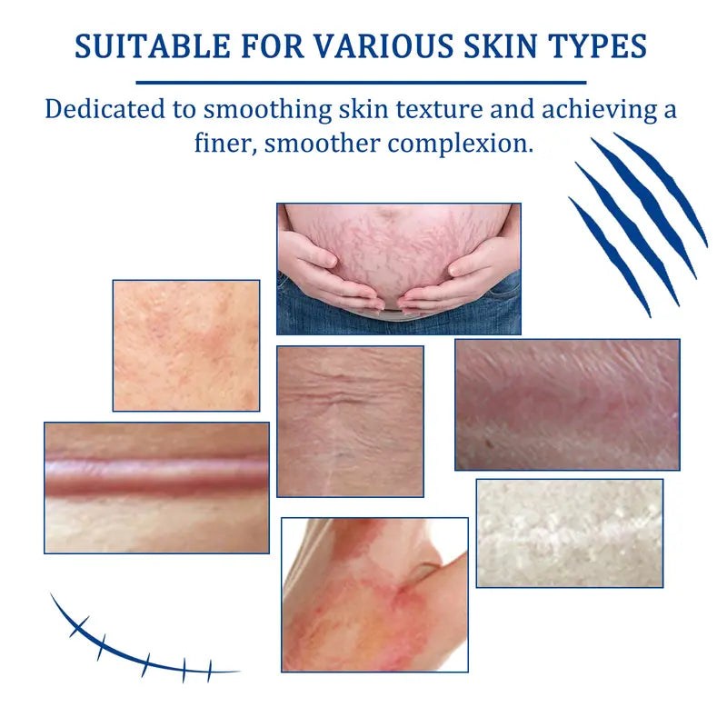 ⚡️ 50% OFF LAST DAY!Scar Cream,Silicone Scar Gel,Scar Removal Cream,Scar Silicone Gel,Scar Gel-A01