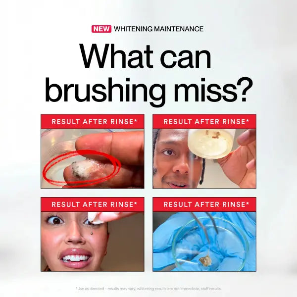 Hismile iD Stain Whitening Mouthwash for White Teeth, Freshens Breath with Essential Oils 237ml -A11