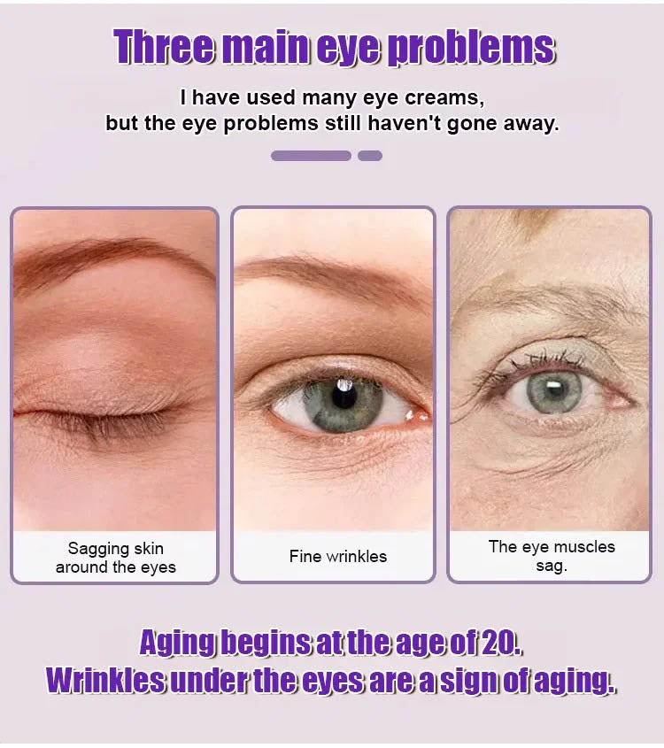 🏆Flash Sale⚡ 50K+ SOLD! 🏆Eye Cream Dark Circle Remover Anti-Aging Firming Lift-HZ