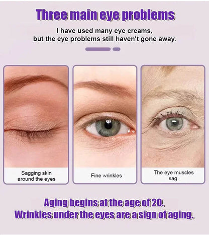 🏆Flash Sale⚡ 50K+ SOLD! 🏆Eye Cream Dark Circle Remover Anti-Aging Firming Lift-HZ