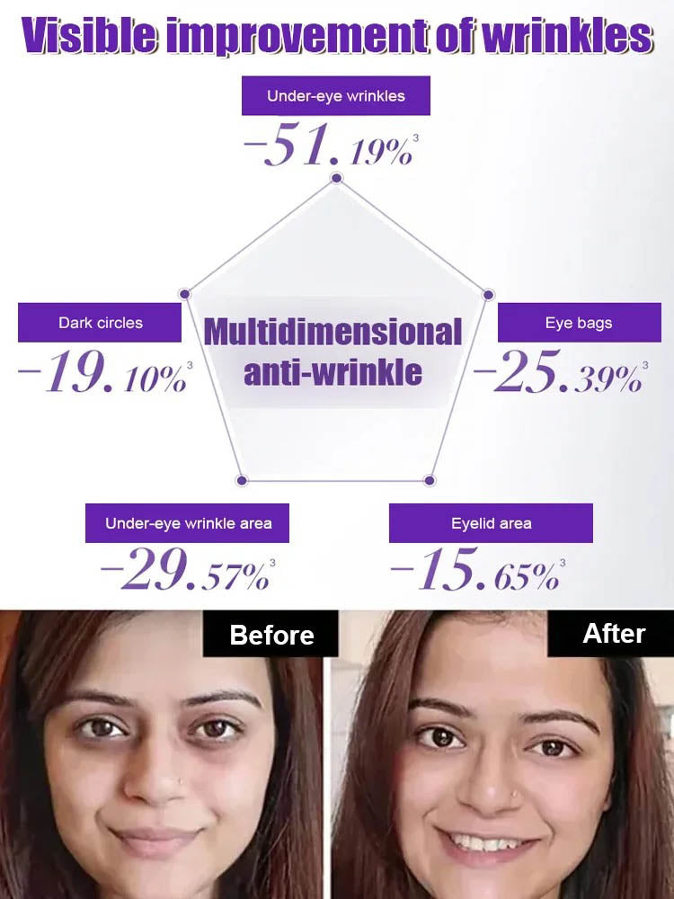 🏆Flash Sale⚡ 50K+ SOLD! 🏆Eye Cream Dark Circle Remover Anti-Aging Firming Lift-HZ
