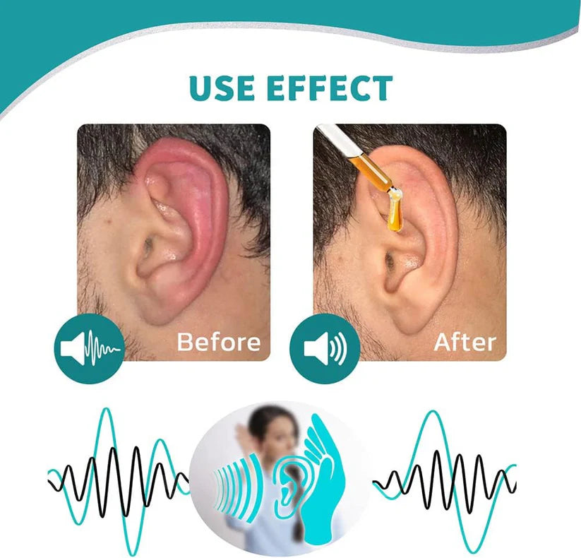 🔥🏆The Exclusive official store🔥Ear Care Drops – Plant-Based Formula-#YEP8