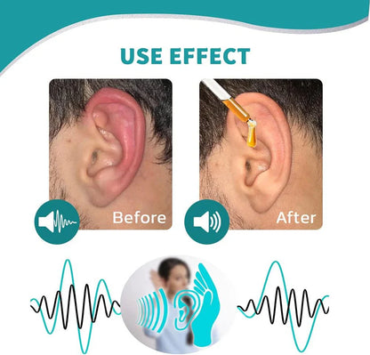 🔥🏆The Exclusive official store🔥Ear Care Drops – Plant-Based Formula-#YEP8