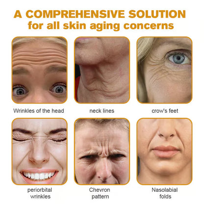 SimpleSigil™👨‍⚕️Botox Bee Venom Wrinkle Removal Cream -W18