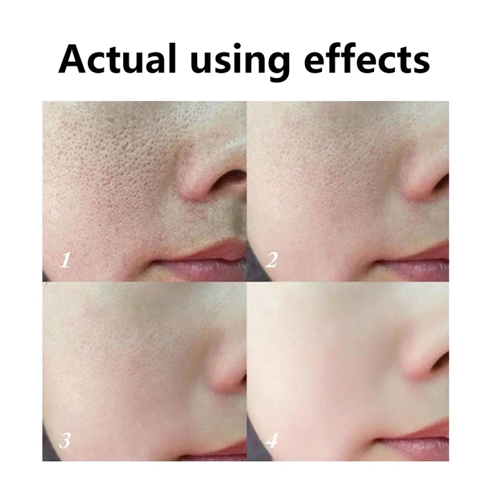 SimpleSigil Lanolin & Salicylic Acid Pore-Tightening Soap-ALB