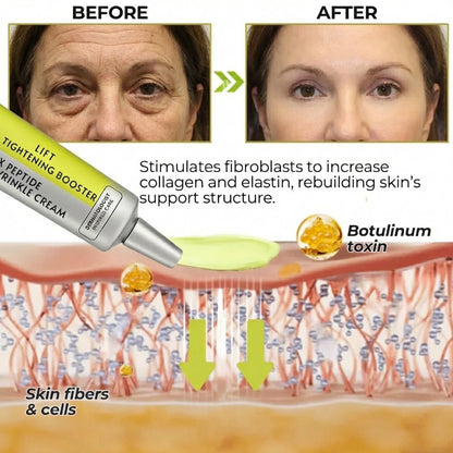 🏆Flash Sale⚡Get Botox-Level Tightening Without the Needle, Stroke Face, or 800 Maintenance! - YTY5