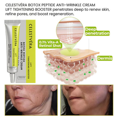 🏆Flash Sale⚡Get Botox-Level Tightening Without the Needle, Stroke Face, or 800 Maintenance! - YTY5