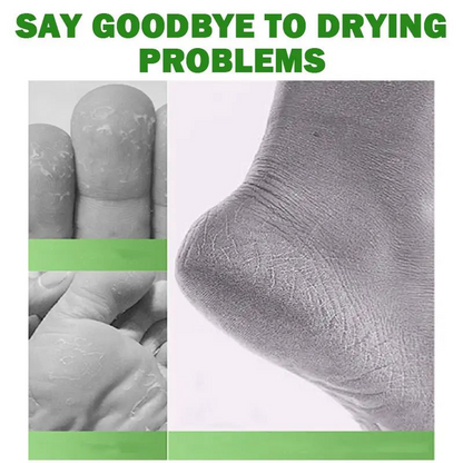 🏆Flash Sale⚡ 15K+ SOLD! 🏆- Tea tree oil foot cream - YTY5