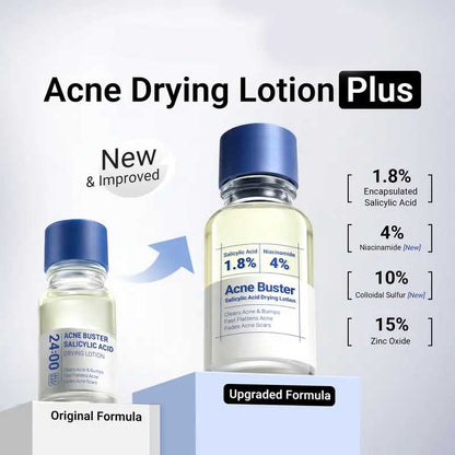 ⚡Crazy-Sale⚡60k-Sold⚡Drying Lotion Plus | Acne & Pimple Treatment | Visibly Shrinks Pimples in 24 Hours & Helps Fade Acne Marks in 7 Days-A01