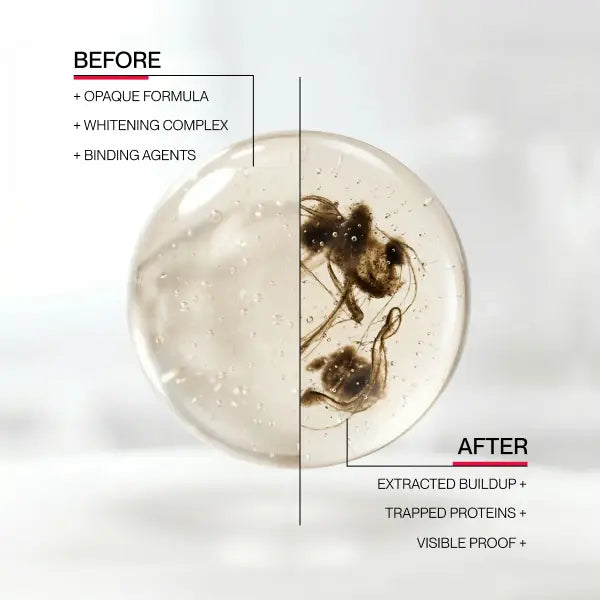 Hismile iD Stain Whitening Mouthwash for White Teeth, Freshens Breath with Essential Oils 237ml -A11