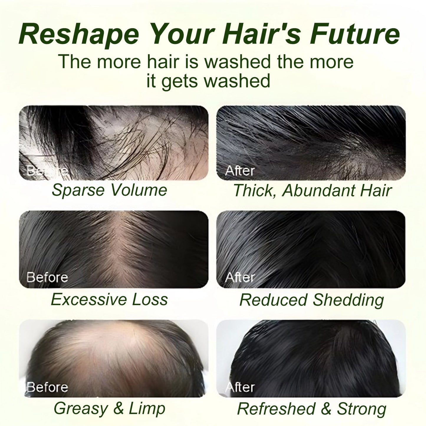 ⚡Crazy-Sale⚡60k-Sold⚡ 100% Natural Ingredients • Batana Oil Shampoo For All Hair Types! ✨-102