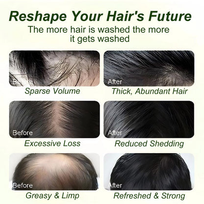 ⚡Crazy-Sale⚡60k-Sold⚡ 100% Natural Ingredients • Batana Oil Shampoo For All Hair Types! ✨-102
