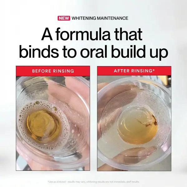 Hismile iD Stain Whitening Mouthwash for White Teeth, Freshens Breath with Essential Oils 237ml -A11