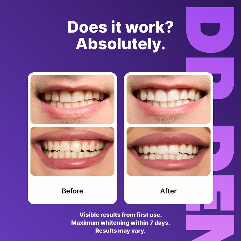 ⏰️Flash-Sale⚡100k-sold⚡Purple Teeth Whitening Strips-YTY5