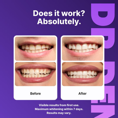 ⏰️Flash-Sale⚡100k-sold⚡Purple Teeth Whitening Strips-YTY5