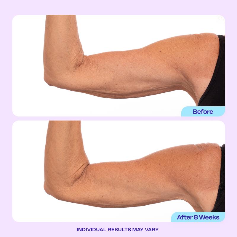 🏆Flash Sale⚡ 120K+ SOLD! 🏆Sculpt & Tone Arm Cream-YTY5