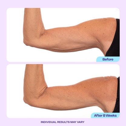 🏆Flash Sale⚡ 120K+ SOLD! 🏆Sculpt & Tone Arm Cream-YTY5