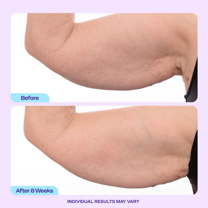 🏆Flash Sale⚡ 120K+ SOLD! 🏆Sculpt & Tone Arm Cream-YTY5