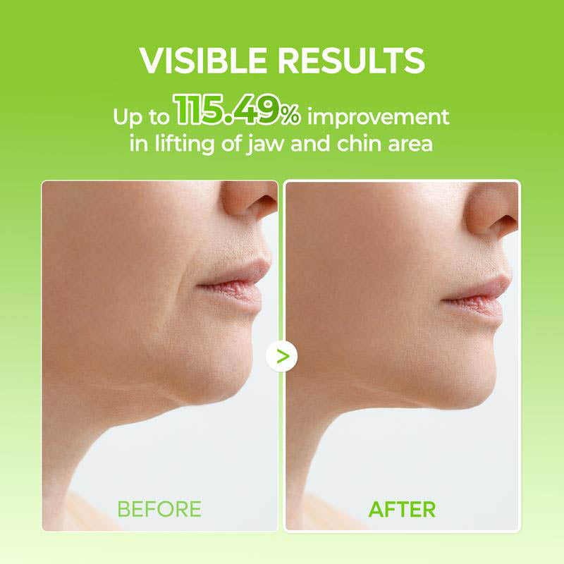 🏆Flash Sale⚡ Newly Upgraded！🏆Bikini Trimmer for Women-ZDQ8