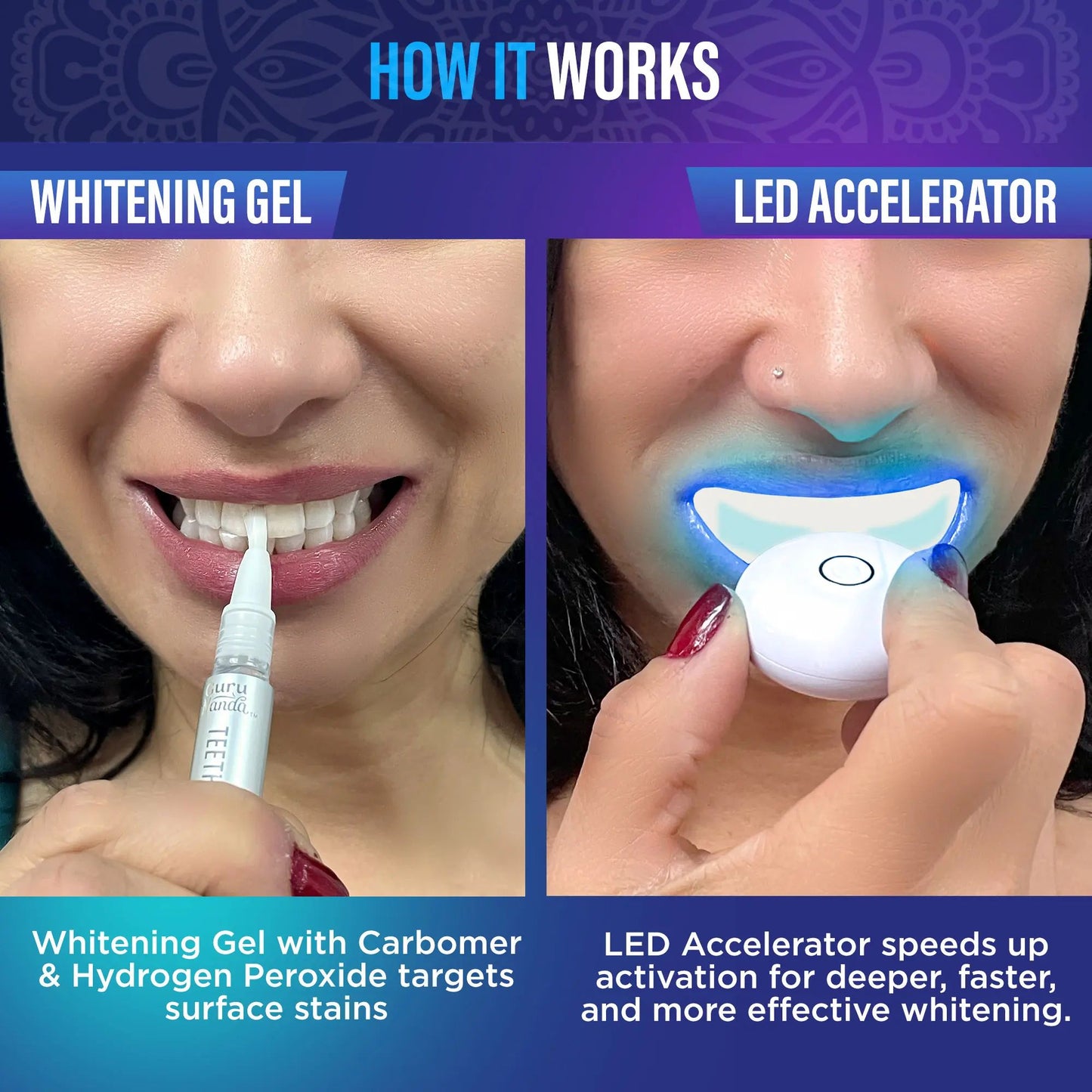 🏆Flash Sale⚡ 60K+ SOLD! 🏆- GuruNanda Professional Whitening Wireless Kit-YTY5