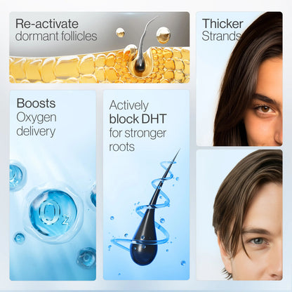 🏆Flash Sale⚡ 60K+ SOLD! 🏆-Advanced Hair Density Roll-On Serum -ZDQ8