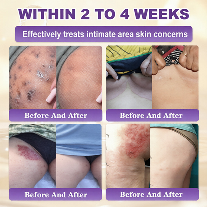 ⏰️Flash-Sale⚡Biotin+ 10D Repair Complex – Unlock Your Skin’s Natural Regeneration⚡-YTY5