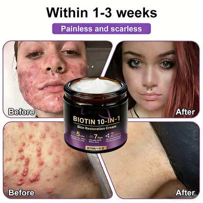⏰️Flash-Sale⚡Biotin+ 10D Repair Complex – Unlock Your Skin’s Natural Regeneration⚡-YTY5