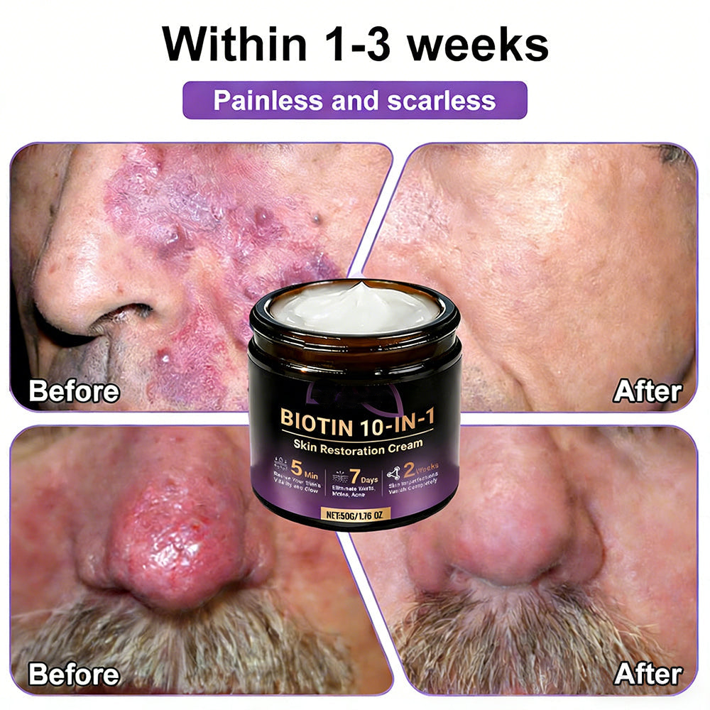 ⏰️Flash-Sale⚡Biotin+ 10D Repair Complex – Unlock Your Skin’s Natural Regeneration⚡-YTY5