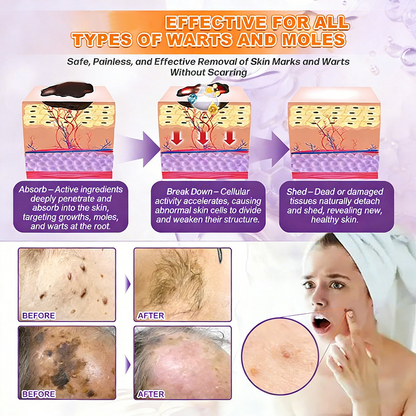 ⏰️Flash-Sale⚡Biotin+ 10D Repair Complex – Unlock Your Skin’s Natural Regeneration⚡-YTY5