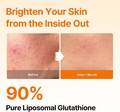 ⚡Crazy-Sale⚡Limited-Time Offer⚡Liposomal Glutathione Strips-YTY5