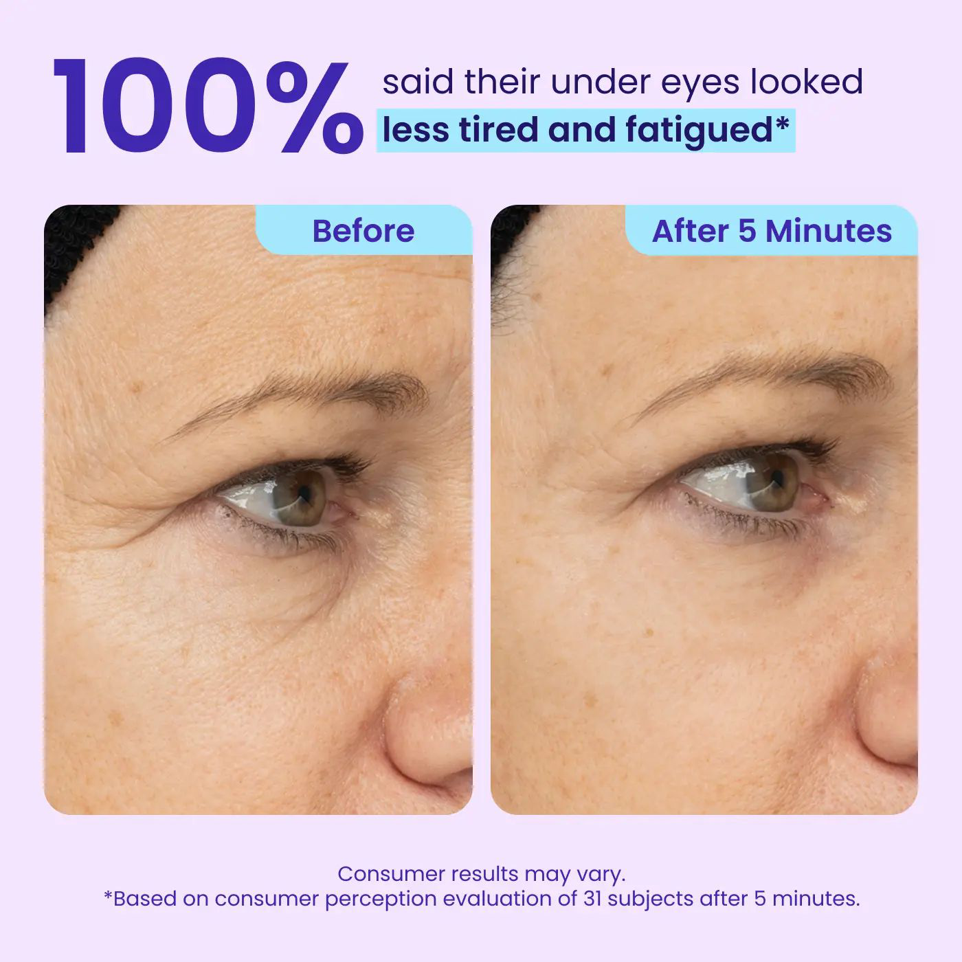 ⚡Crazy-Sale⚡Limited-Time Offer⚡PURE Instant Lift Eye Gel-YTY5