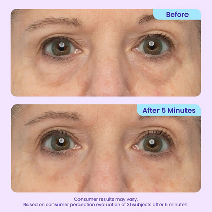 ⚡Crazy-Sale⚡Limited-Time Offer⚡PURE Instant Lift Eye Gel-YTY5