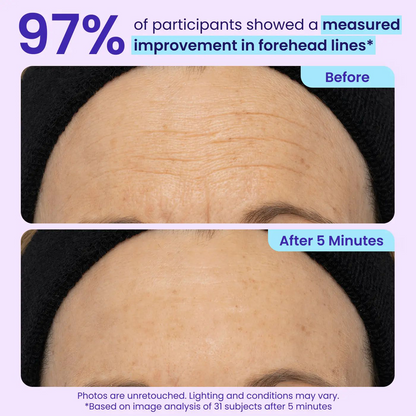 ⚡Crazy-Sale⚡Limited-Time Offer⚡PURE Instant Lift Eye Gel-YTY5