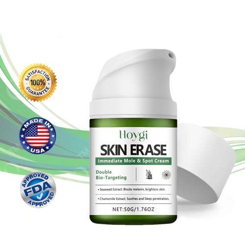 ✅ Official Store: Instant Mole & Spot Cream -W18