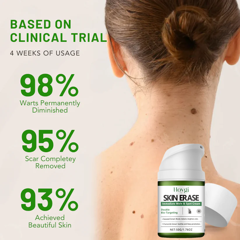 ✅ Official Store: Instant Mole & Spot Cream -W18