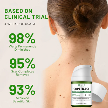 ✅ Official Store: Instant Mole & Spot Cream -W18