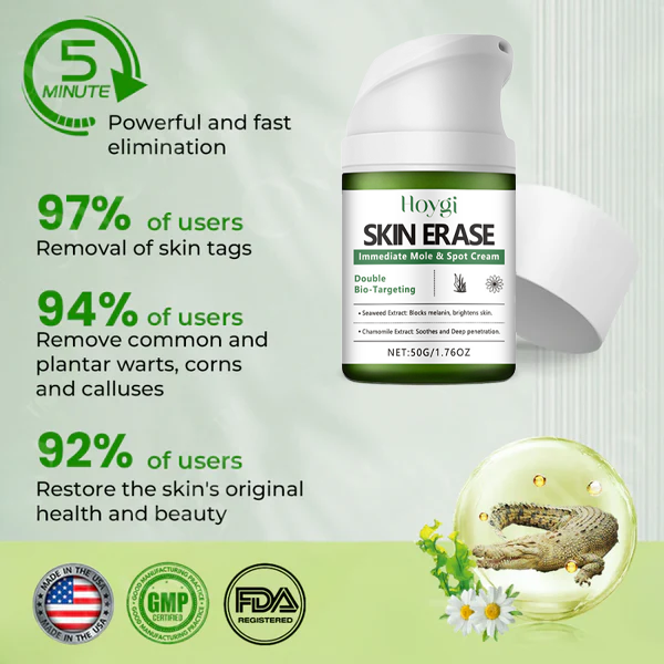 ✅ Official Store: Instant Mole & Spot Cream -W18