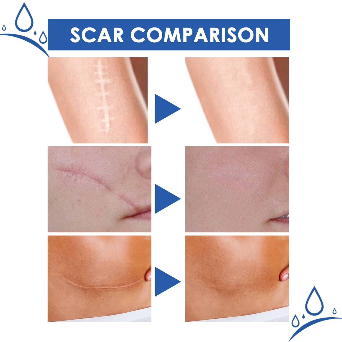 Scar Repair & Firming Cream – Fade Scars, Firm Skin | New Launch-W18