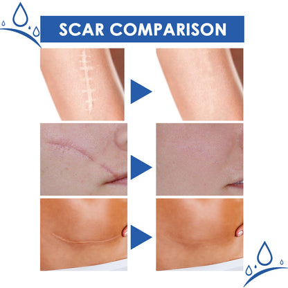 Scar Repair & Firming Cream – Fade Scars, Firm Skin | New Launch-W18