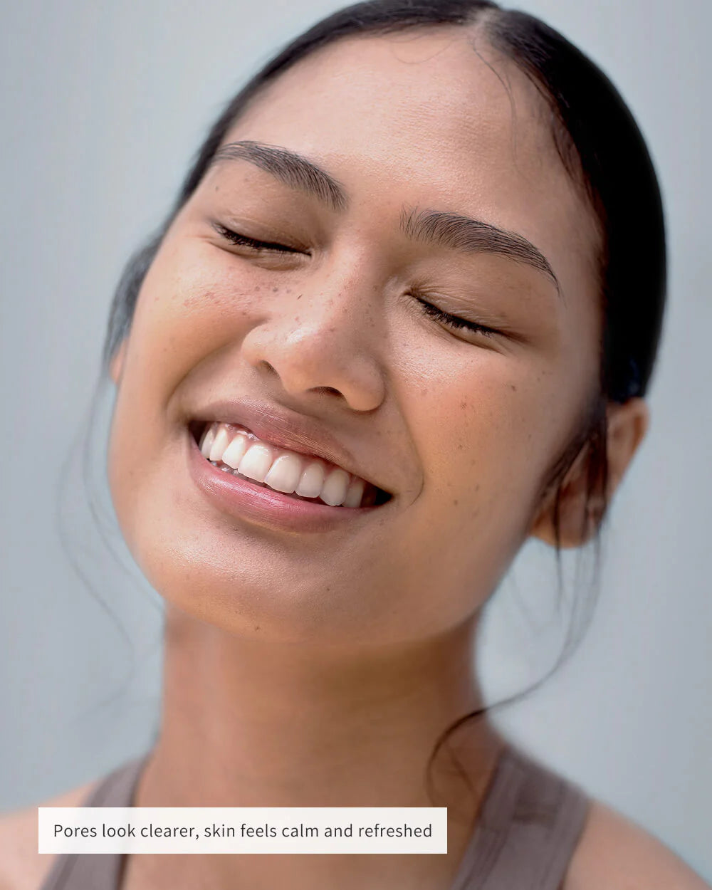 🔥50% OFF Only For Today🔥NOSE PATCHES -W18