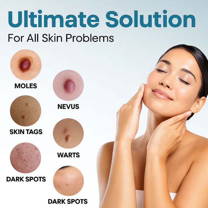 SimpleSigil™Mole & Wart Removal Laser Pen-W18