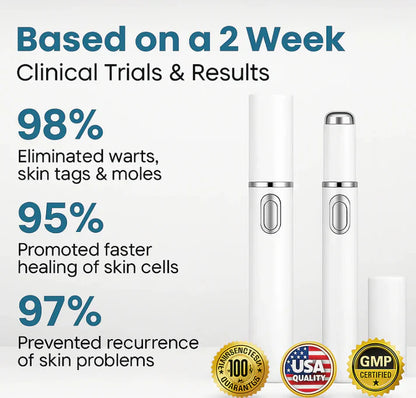 SimpleSigil™Mole & Wart Removal Laser Pen-W18