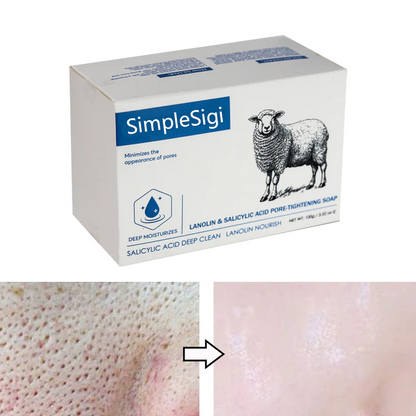 SimpleSigil Lanolin & Salicylic Acid Pore-Tightening Soap-ALB