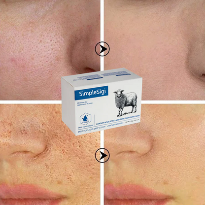 SimpleSigil Lanolin & Salicylic Acid Pore-Tightening Soap-ALB