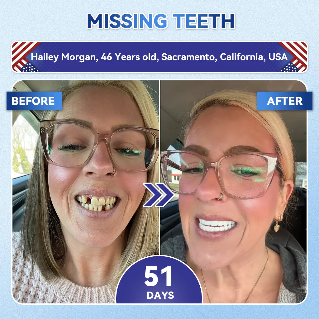 ⚡Crazy-Sale⚡69k-Sold⚡Fast‑Dissolving Tooth & Gum Repair Oral Strips-A11