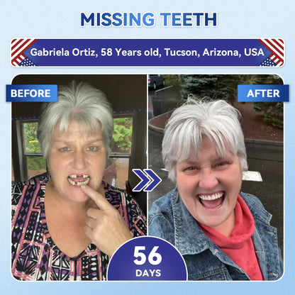 ⚡Crazy-Sale⚡69k-Sold⚡Fast‑Dissolving Tooth & Gum Repair Oral Strips-A11
